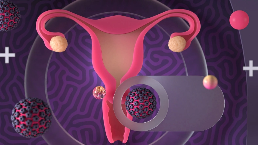 female cancer symptoms